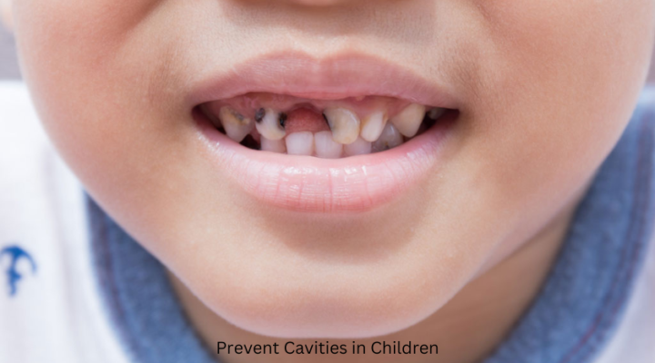 Prevent Cavities in Children