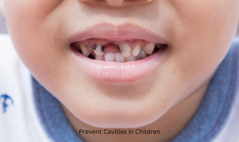 10 Dental Tips To Prevent Cavities In Children