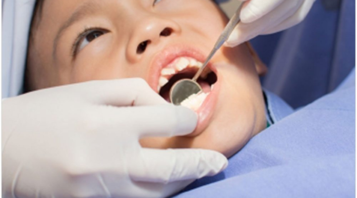 Silver Diamine Fluoride - Joyful Smiles Pediatric Dentistry of Bradley