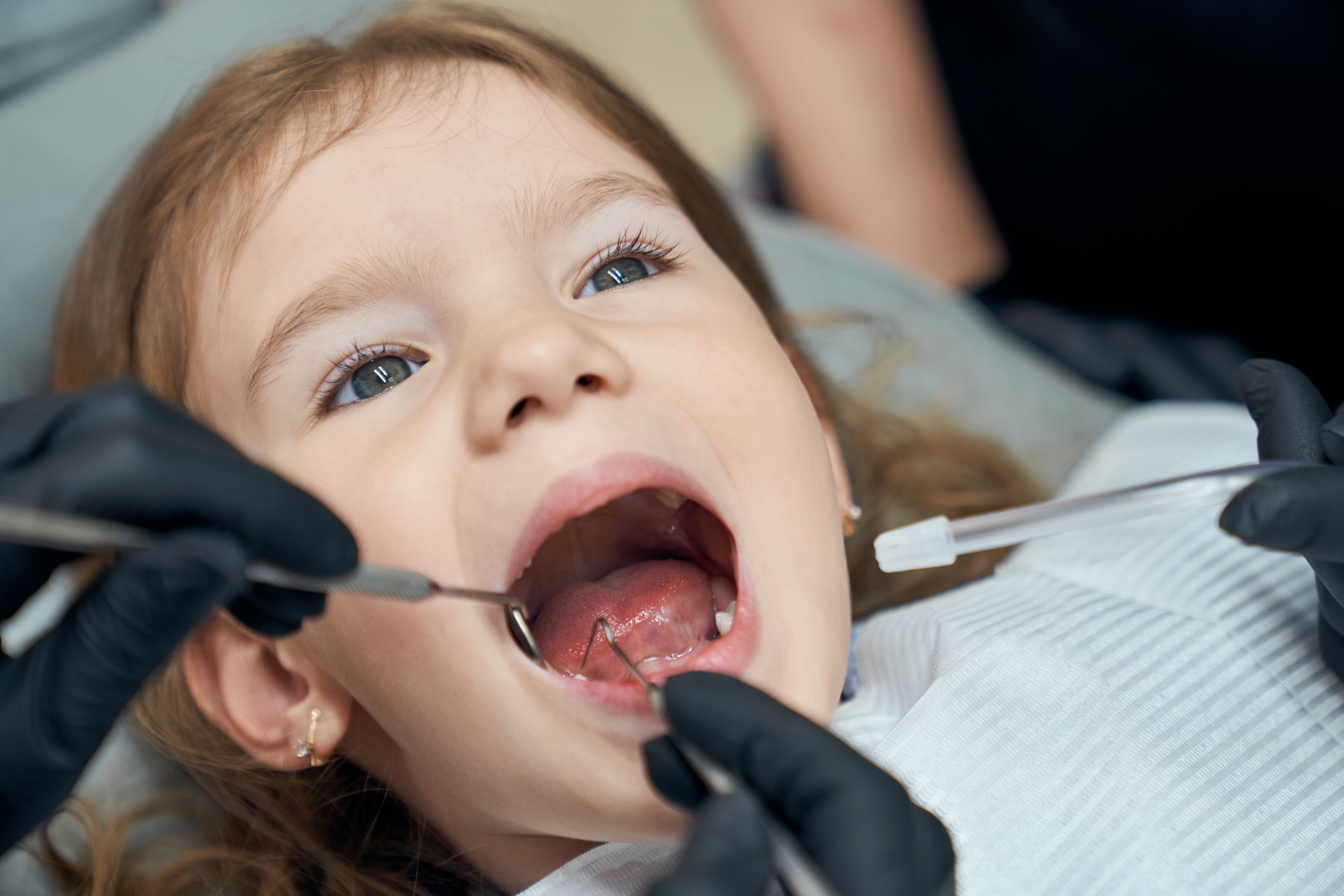 Unlocking Bright Smiles: The Profound Benefits Of Pediatric Dentistry