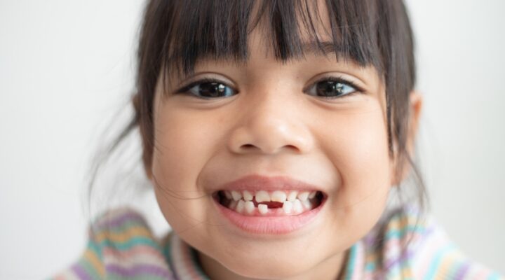 Children Root canal Therapy in Bradley IL, Joyful Smiles Pediatric Dentistry Of Bradley