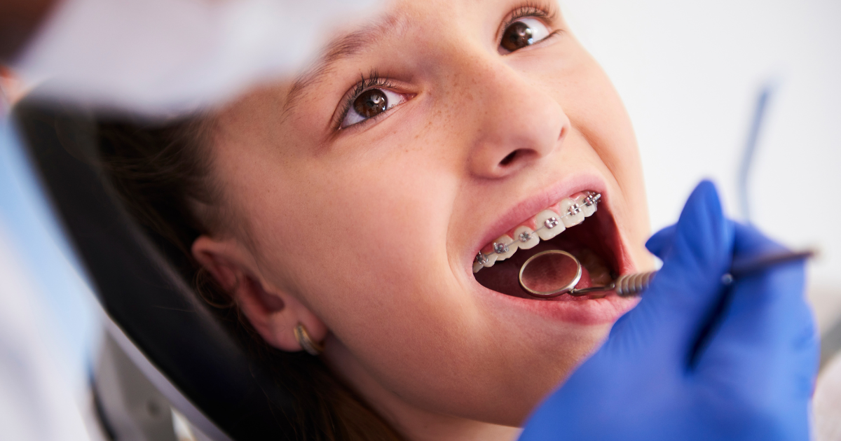 Does My Child Need Braces? Common Orthodontic Issues in Kids