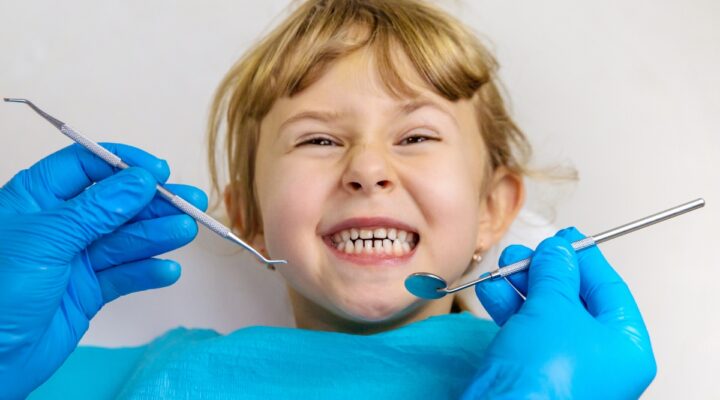 composite-restorations-in-Bradley